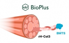 ���̿��÷���, �۷ι� ������ ���� ������ ���ѱ� ���� ������ ������ �ΰ��� �ݶ�� Ÿ�ԥ��� ���� ����